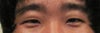 My rt eye has a little more fat in my eyelid, thus makes my eye smaller and heavier