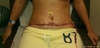 24 hours post op, first and last flat day I have seen.