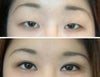I'm unable to transfer my pic to the comp so I tried to find pics with similar crease height. The 'after' picture of this girl has the same height as my crease now.