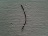 suture that came from abscess 8 months post op