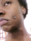 My bruised left cheek...