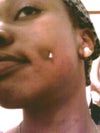 Bruised left cheek when I smile...