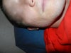 it is very similar on both sides of face