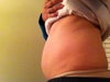look pregnant from side, but no stretch marks or anything.