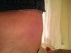 Tummy bulge photo taken from left side.
