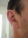 Right ear.