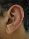 Left ear.