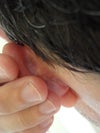 Left ear.