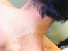 Shoulder