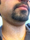 Side of my face to my neck.