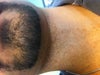 Neck