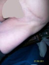 My doctors don't want to see me to talk about what happened.