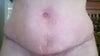 lower area, also enlarged pubic area