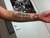 my skin colour and tattoo im concerned about removing