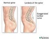 Lordosis or posterior pelvic tilt ignored I feel.