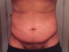 2 weeks front