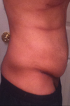 2 weeks side