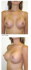 #1 Choice in shape and size