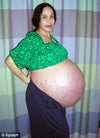 Pregnant with octuplets