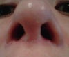 right nasal sill larger