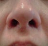 right nostril appears larger