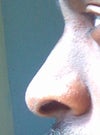 side