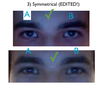 a rough idea of what my eyes should look like if they were symmetrical (this is Edited)