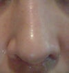 Top view - notice lack of crease on left nostril