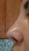 Left nostril no crease