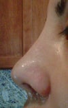 Notice slight bump above left nostril where crease should be