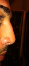 Before