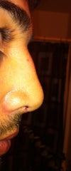 After "He did not break my nose just rasped and filed it down"