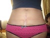 before, frontal
