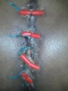 retention stitches