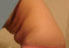 Side view, scrunching my stomach looks horrible, this happens when I sit