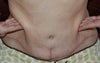 This view shows difference in tightness between left/right.