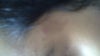 this is a smaller patch. Its lighter than the other one.