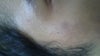 this is a larger patch. It looks red but in reality its actually dark.