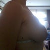 rigth breast
