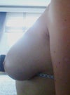 left breast