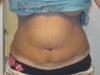 FRONT VIEW AT 2.5 MONTHS