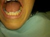 the nasty tooth