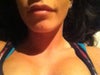 About 5 days after the injections