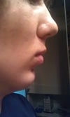 2 months after