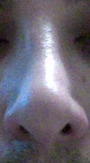 Frontal View