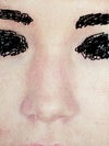 this is before surgery
