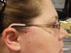 This was the day after the hair removal.