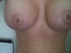 breast front close-up
