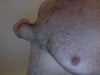 Pulling Chest Skin Out