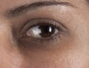 My Eye